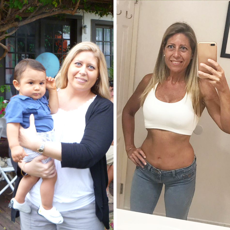 Comparación antes y después en abdomen de mujer tras usar Vibro Sculpt para reducción y firmeza