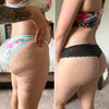 Comparación antes y después en glúteos femeninos mostrando reducción de celulitis con Vibro Sculpt