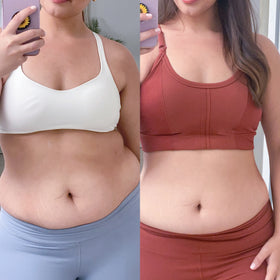Resultados visibles antes y después en abdomen de mujer tras tratamiento con Vibro Sculpt.